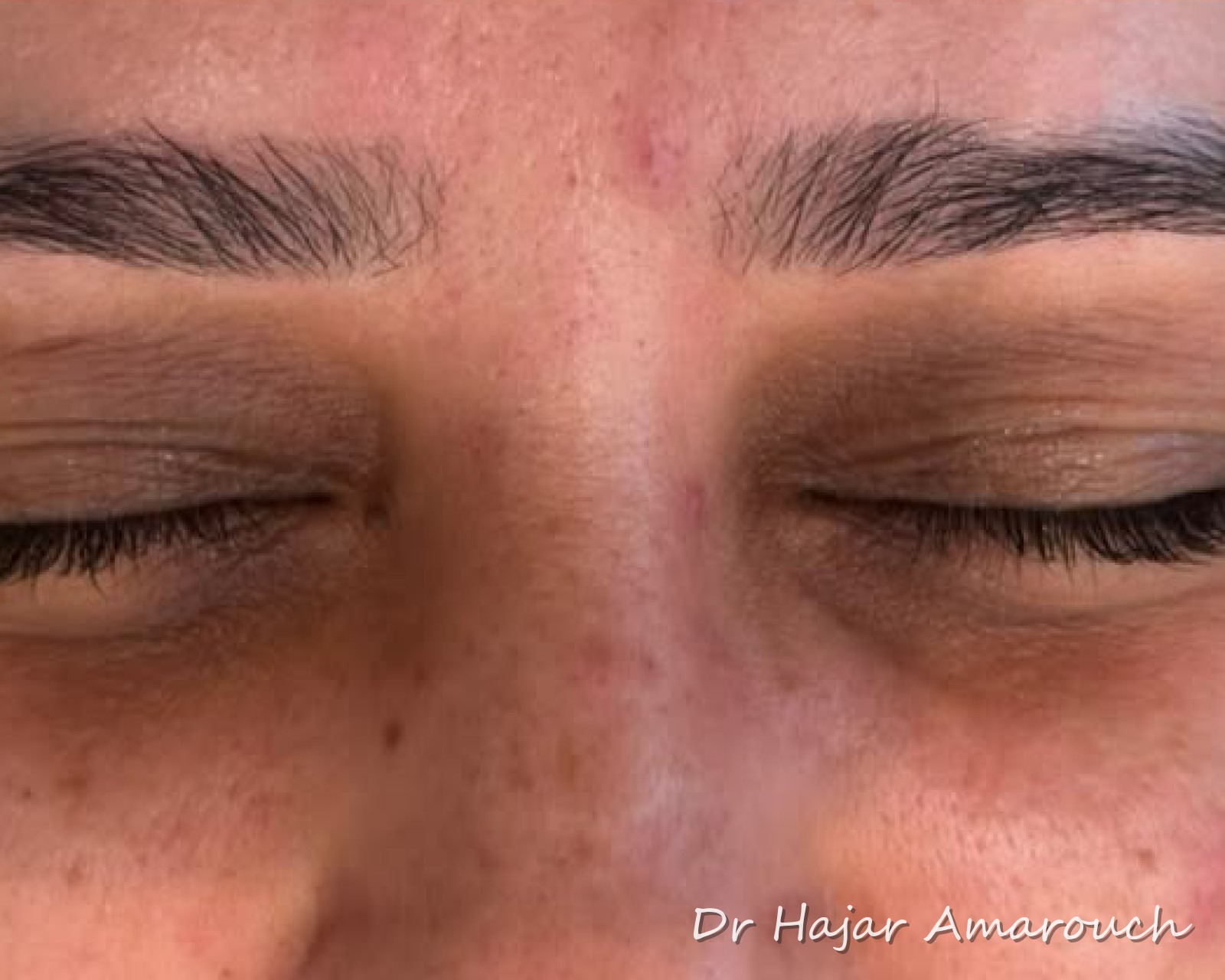 Avant — Regard reposé & sourcils